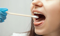 Spit science: why saliva is great way to detect disease