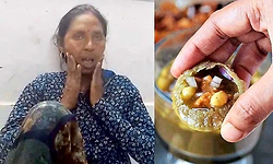 Video: ಪಾನಿಪುರಿ ತಿನ್ನುವ ಭರದಲ್ಲಿ ಜಾರಿದ ದವಡೆ... ಮಹಿಳೆ ಆಸ್ಪತ್ರೆಗೆ ದಾಖಲು