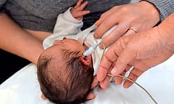 Hearing: ನವಜಾತ ಶಿಶು-ಶ್ರವಣ ಪರೀಕ್ಷೆ ; ಇದು ಕೇವಲ ಒಂದು ಕ್ಷಿಪ್ರ ಪರೀಕ್ಷೆಯಷ್ಟೇ ಅಲ್ಲ...!