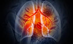 A Pulmonologist's Blueprint for Better Lung Health During Winter