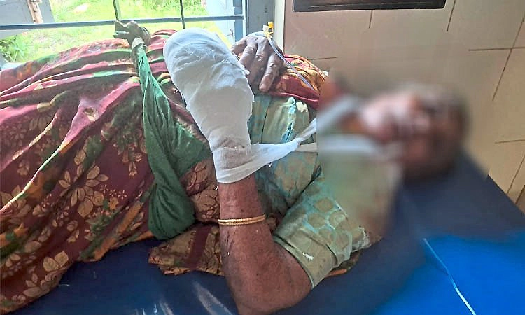 Thirthahalli: ಶಿಕಾರಿಗೆ ಇಟ್ಟಿದ್ದ ಕಚ್ಚಾ ಬಾಂ*ಬ್‌ ಸಿಡಿದು ಮಹಿಳೆಯ 5 ಬೆರಳು ಕಟ್