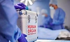 Organ Transplants: ದೇಶದಲ್ಲಿ ಮೊದಲ ಬಾರಿಗೆ ವರ್ಷಕ್ಕೆ 20 ಸಾವಿರಕ್ಕೂ ಹೆಚ್ಚು ಅಂಗಾಂಗ ಕಸಿ