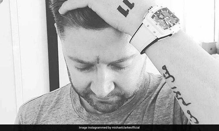 I have had number of cut-outs on my face: Clarke on his fight against skin cancer