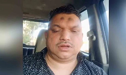 Man dies as car catches fire in Kerala's Wayanad; wife, children suffer burns