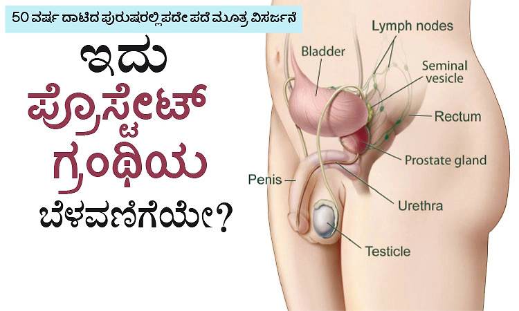 Prostate Gland: 50 ವರ್ಷ ದಾಟಿದ ಪುರುಷರಲ್ಲಿ ಪದೇ ಪದೆ ಮೂತ್ರ ವಿಸರ್ಜನೆ