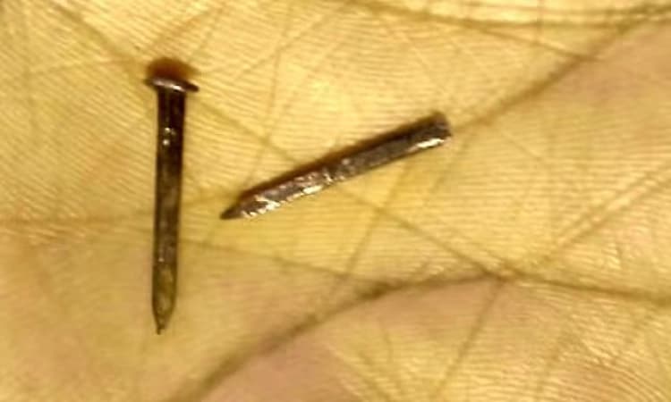 Kasaragod: Student injured after nail pierces hand while playing at school 