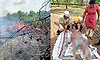 Elderly man seriously injured while trying to douse garden fire in Karkala