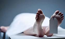 Udupi: ಅನಾರೋಗ್ಯದಿಂದ ಸಾವು