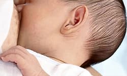 Kasaragod: ಎದೆ ಹಾಲು ಗಂಟಲಲ್ಲಿ ಸಿಲುಕಿ ಶಿಶು ಸಾವು