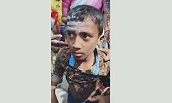 ಮಲೆಮಹದೇಶ್ವರ ಬೆಟ್ಟದಲ್ಲಿ ಮತ್ತೊರ್ವ ಪಾದಯಾತ್ರಿಕನ ಮೇಲೆ ಚಿರತೆ ದಾಳಿ!