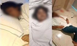 Bengaluru man allegedly kills two daughters in hotel, attempts suicide