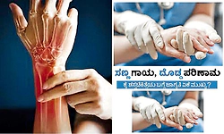 Hand Surgery: ಸಣ್ಣ ಗಾಯ,ದೊಡ್ಡ ಪರಿಣಾಮ: ಕೈ ಶಸ್ತ್ರಚಿಕಿತ್ಸೆಯ ಬಗ್ಗೆ ಜಾಗೃತಿ ಏಕೆ ಮುಖ್ಯ?