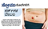 Stoma: ಸ್ಟೋಮಾ ರೋಗಿಗಳಿಗೆ ನರ್ಸ್‌ಗಳ ಬೆಂಬಲ