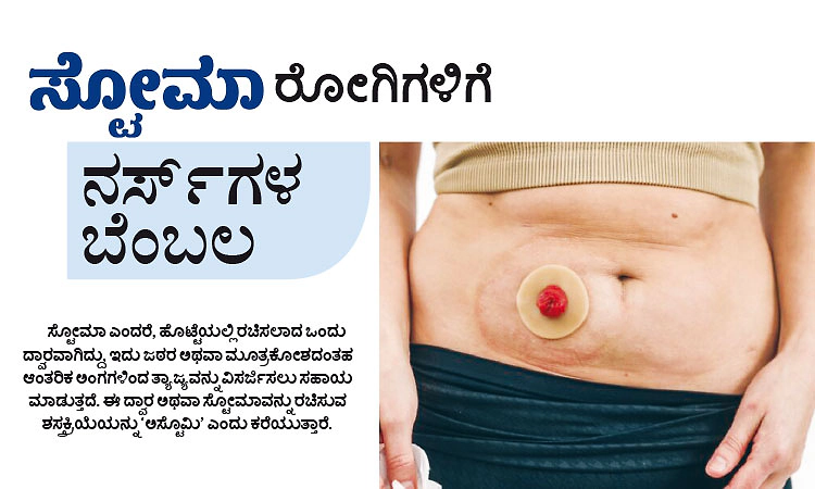 Stoma: ಸ್ಟೋಮಾ ರೋಗಿಗಳಿಗೆ ನರ್ಸ್‌ಗಳ ಬೆಂಬಲ