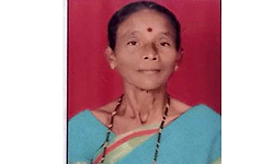 Belthangady: ಬೆಂಕಿ ತಗಲಿ ಗಾಯಗೊಂಡಿದ್ದ ಮಹಿಳೆ ಸಾವು