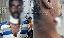 Hunsur: ಚಿರತೆ ದಾಳಿಗೆ ಕೂಲಿ ಕಾರ್ಮಿಕ ಗಾಯ, ಸ್ಪಂದಿಸದ ಇಲಾಖೆ