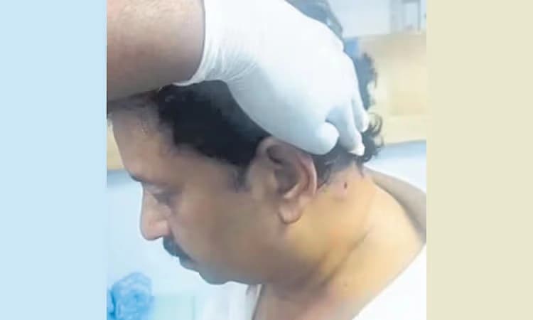 Businessman injured in shooting incident in Bengaluru’s Basavanagudi