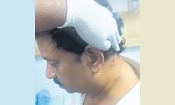 ಪಾರ್ಕ್‌ನಲ್ಲಿ ರಾತ್ರಿ ವೇಳೆ ಉದ್ಯಮಿ ಮೇಲೆ ಫೈರಿಂಗ್‌