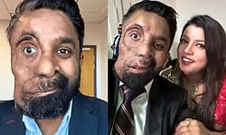 ಸೌಂದರ್ಯ ಅಡಗಿರುವುದು ಗುಣದಲ್ಲಿ ಹೊರತು ರೂಪದಲ್ಲಲ್ಲ: 26 ಶಸ್ತ್ರಚಿಕಿತ್ಸೆ ಕಂಡ ಯುವಕನ ಕಥೆ!