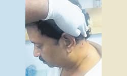 ಬಸವನಗುಡಿಯಲ್ಲಿ ಉದ್ಯಮಿ ಮೇಲೆ ಗುಂಡು ಹಾರಿಸಿದ್ದು ವಿದ್ಯಾರ್ಥಿ!