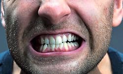 Oral: ಒತ್ತಡ ಮತ್ತು ಬಾಯಿಯ ಆರೋಗ್ಯ; ನಿಮಗೆ ಗೊತ್ತಿಲ್ಲದೆಯೇ ಹಲ್ಲು ಕಡೆಯುತ್ತಿದ್ದೀರಾ ?