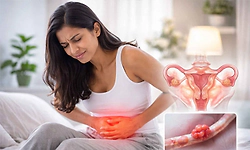 Endometriosis: ಎಂಡೊಮೆಟ್ರಿಯೋಸಿಸ್‌:  ಮುಂದೇನು?