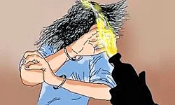 ಪಂಜಾಬ್‌ನ ಲೂಧಿಯಾನದಲ್ಲಿ ಮಹಿಳೆ ಮೇಲೆ ಆ್ಯಸಿಡ್‌ ದಾಳಿ