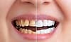 Teeth Whitening Tips: ನೈಸರ್ಗಿಕವಾಗಿ ಹಲ್ಲುಗಳನ್ನು ಬಿಳಿಗೊಳಿಸಲು 8 ಮನೆಮದ್ದುಗಳು