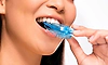 Mouth Guard: ಆರ್ಥೊಡಾಂಟಿಕ್‌ ಬ್ರೇಸ್‌ಗಳು ಮತ್ತು ಕ್ರೀಡಾಗಾಯಗಳು