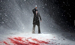 Toxic: ಮತ್ತೆ ಧೂಳೆಬ್ಬಿಸಲು ರೆಡಿಯಾದ ರಾಯ..: 'ಟಾಕ್ಸಿಕ್‌' ಟೀಸರ್‌ ರಿಲೀಸ್‌ ದಿನಾಂಕ ನಿಗದಿ