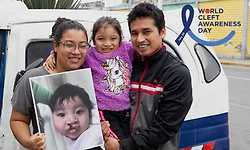 July 20 marks World Cleft Awareness Day: Raising awareness, breaking stigma and transforming lives