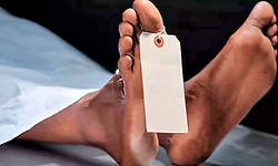 Udupi: ಅನಾರೋಗ್ಯ ಸಮಸ್ಯೆ: ವ್ಯಕ್ತಿ ಸಾವು