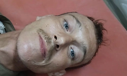 Udupi: Russian national found collapsed on roadside, rescued