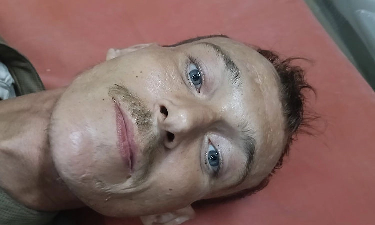 Udupi: Russian national found collapsed on roadside, rescued
