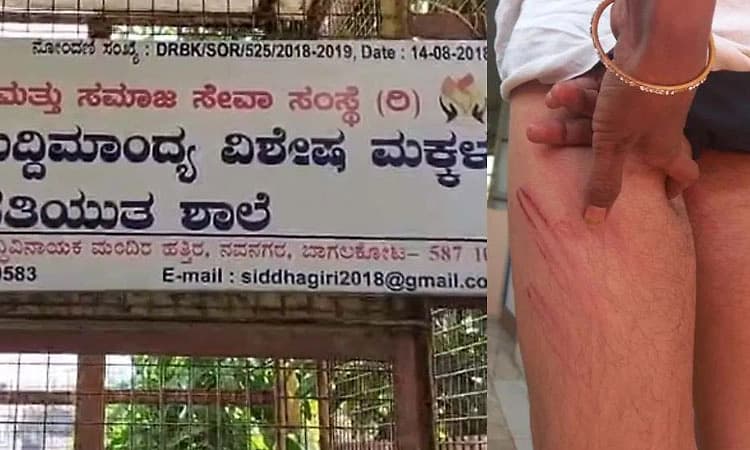 ಬುದ್ಧಿಮಾಂದ್ಯ ಬಾಲಕನಿಗೆ ದಂಪತಿಯಿಂದ ರಣಹಿಂಸೆ