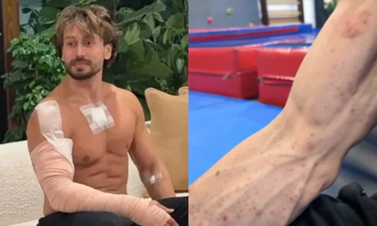 Video: Tiger Shroff reveals injury marks after alleged assassination attempt