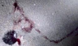 Belthangady; ಹತ್ಯಡ್ಕ ಗ್ರಾಮದ ಉಪ್ಪರಡ್ಕ ರಸ್ತೆಯಲ್ಲಿ ಪ್ರಾಣಿಗಳ ರಕ್ತ ಪತ್ತೆ