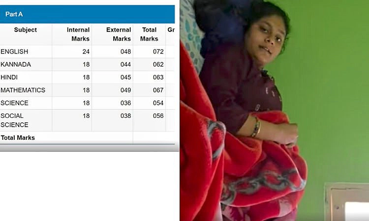 SSLC: ಸ್ಟ್ರೆಚರ್‌ನಲ್ಲಿ ಮಲಗಿಕೊಂಡು ಪರೀಕ್ಷೆ ಬರೆದಿದ್ದ ವಿದ್ಯಾರ್ಥಿನಿಗೆ 374 ಅಂಕ 