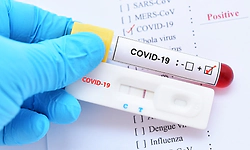 Two more persons test positive for COVID in Odisha