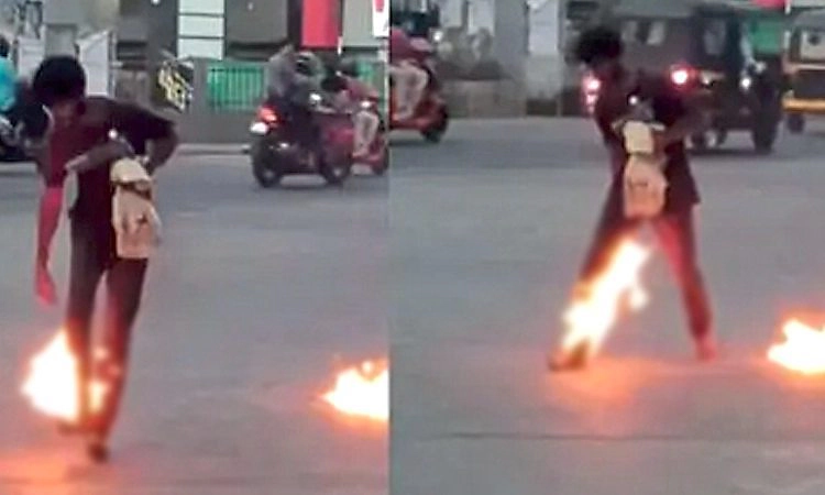 Udupi: ಕಲ್ಸಂಕದಲ್ಲಿ ಸಜೀವ ದಹನಕ್ಕೆ ಯತ್ನಿಸಿದಾತನಿಗೆ ವೆನ್ಲಾಕ್‌ನಲ್ಲಿ ಚಿಕಿತ್ಸೆ