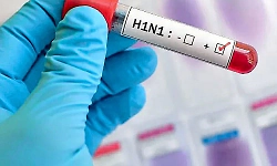 Woman with suspected H1N1 shifted to hospital in Hubballi 