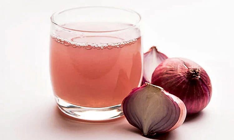 ತ್ವಚೆ ಮತ್ತು ಕೂದಲಿನ ಸೌಂದರ್ಯಕ್ಕೆ 'ಈರುಳ್ಳಿ ರಸ'; ಇದರಲ್ಲಿದೆ ಅದ್ಭುತ ಪ್ರಯೋಜನಗಳು