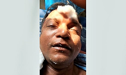 Udupi: ಪ್ರಯಾಣಿಕ ಅಸ್ವಸ್ಥ: ಜಿಲ್ಲಾಸ್ಪತ್ರೆಗೆ ದಾಖಲು