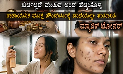 ಮುಖದ ಅಂದ ಕೆಡಿಸುವ ಕಪ್ಪು ಕಲೆಗಳಿಗೆ ಅಡುಗೆಮನೆಯಲ್ಲೇ ಇದೆ ಮದ್ದು!