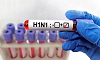 Rise in H1N1 cases: Is vaccination mandatory for everyone above 65? Here is what ICMR said