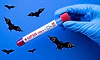Kozhikode: Deadly Nipah virus sparks high alert in Kerala as businessman tests positive
