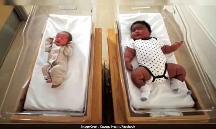 Newborn in New York weighs 5.9 kg, as heavy as a three-month-old infant !