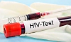 Karnataka to conduct HIV screening for college students amid rise in infections among youth