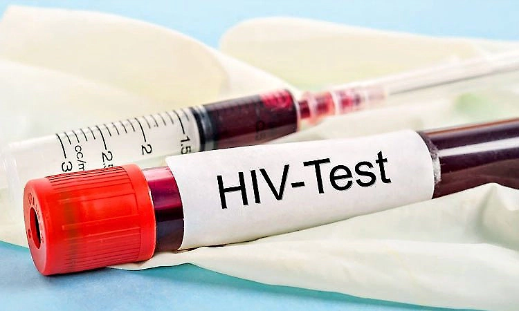 Karnataka to conduct HIV screening for college students amid rise in infections among youth