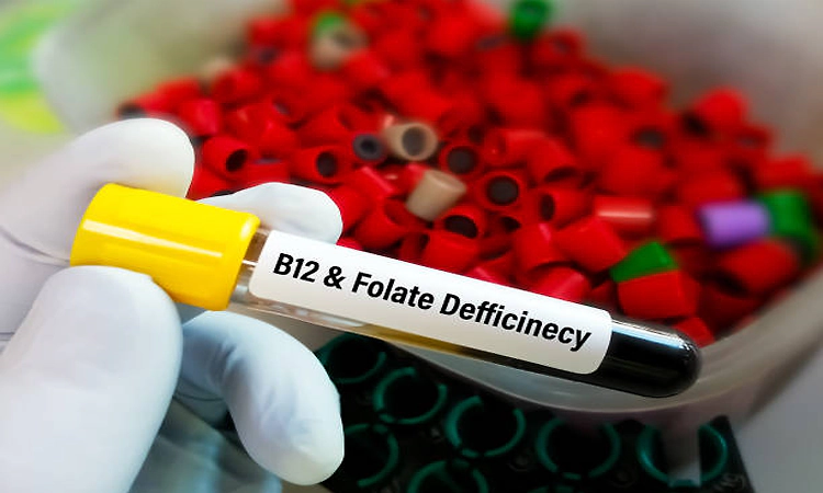 Vitamin B12, folate deficiencies could be related with fatigue, reduced motivation: Study